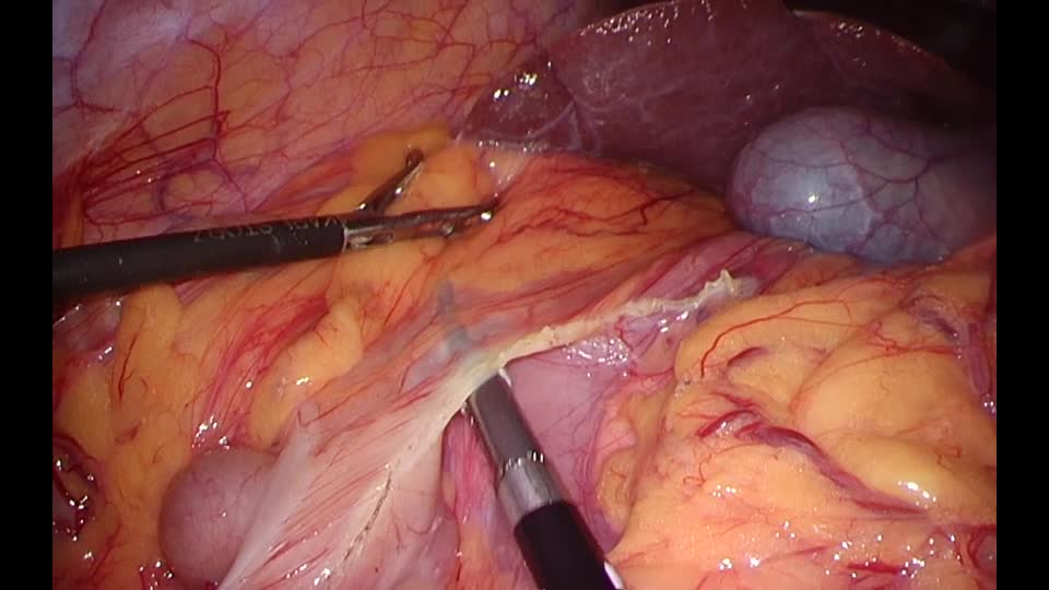 78-02-082茂原論文　動画２　図３