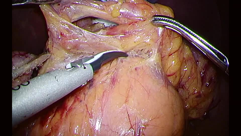 78-02-031木下論文　動画１　図１
