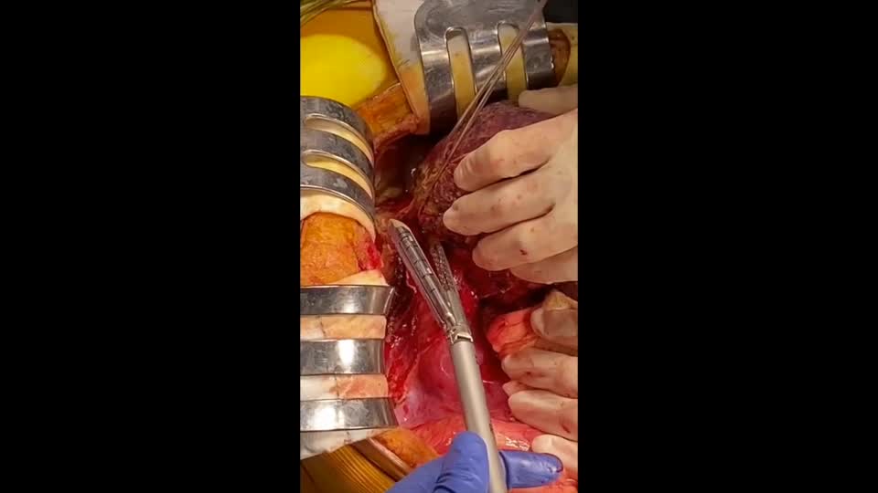 78-02-191原田論文　動画１