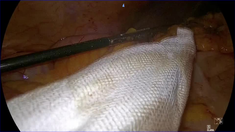 kd78002田中論文　LapSSS　動画２