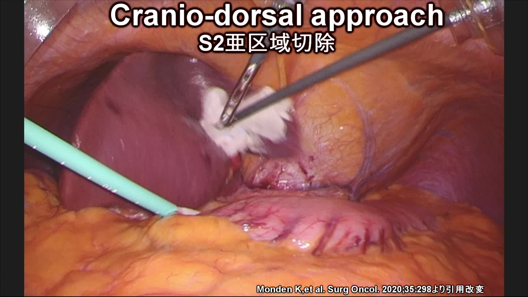 78-03-034門田論文　動画4図5