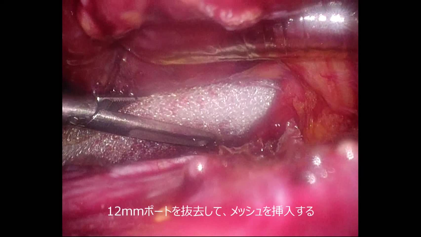 78-04-093蛭川論文　動画3図6
