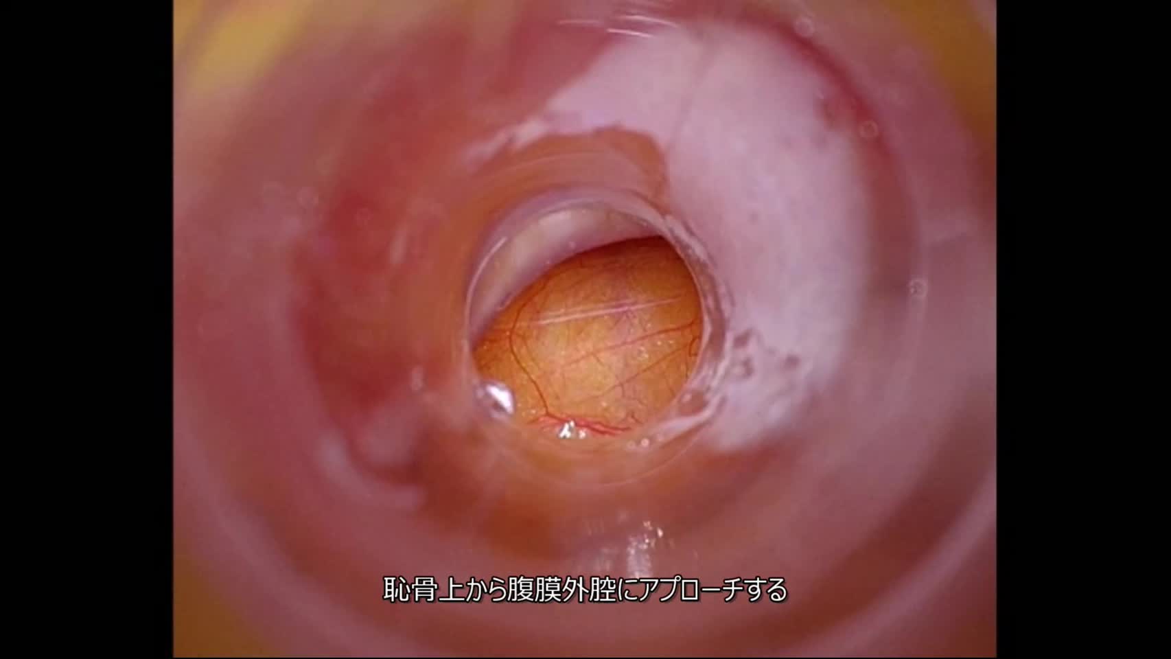 78-04-094蛭川論文　動画4図7