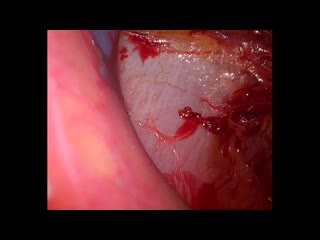 78-04-111長浜論文　動画1図4，5