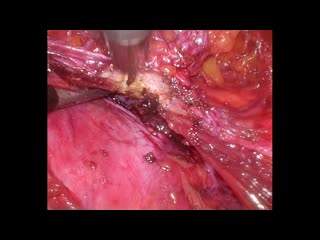 78-04-112長浜論文　動画2図7