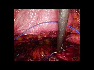 78-04-113長浜論文　動画3図8c,d