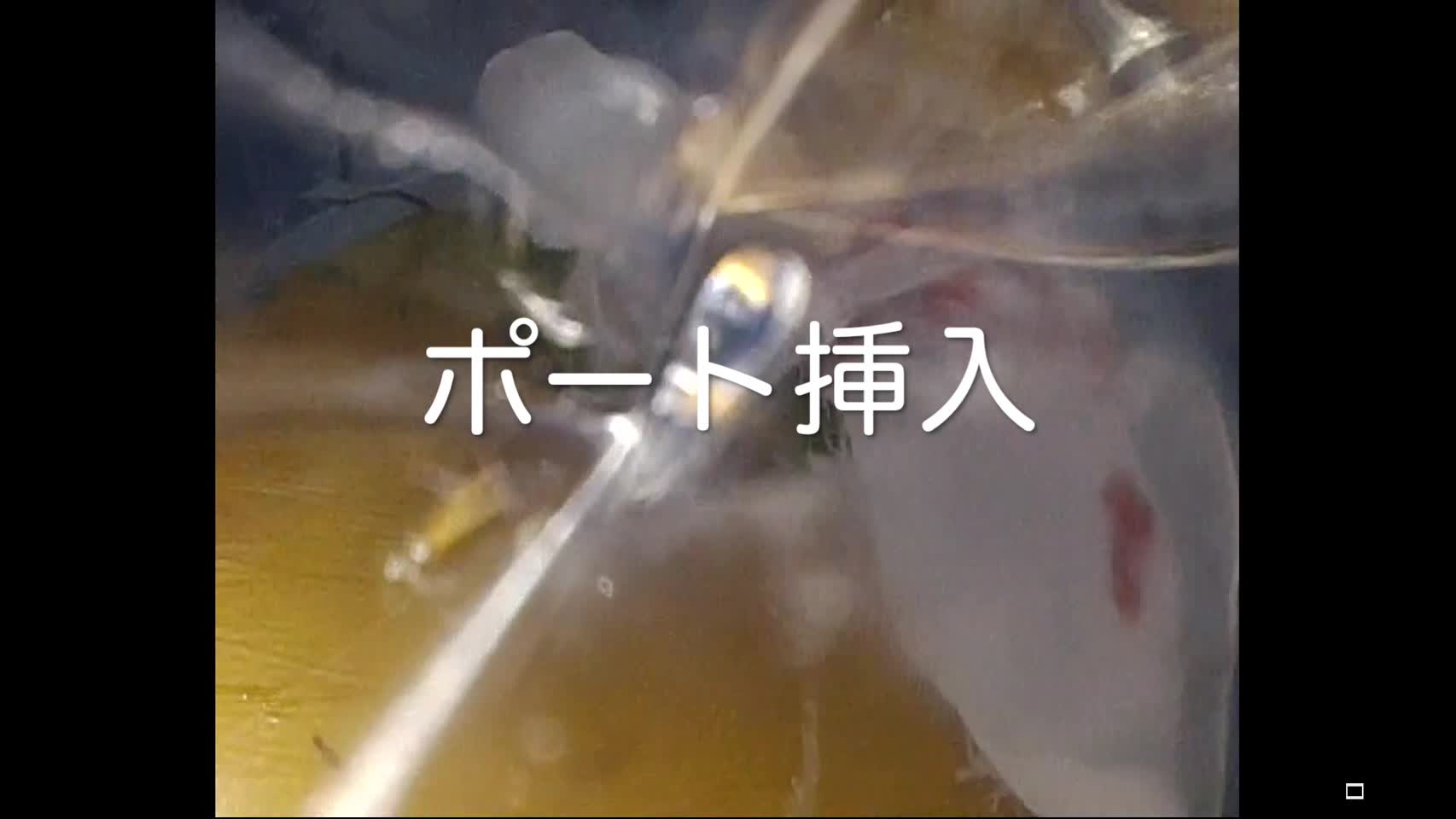 78-04-051谷岡論文　動画1図2