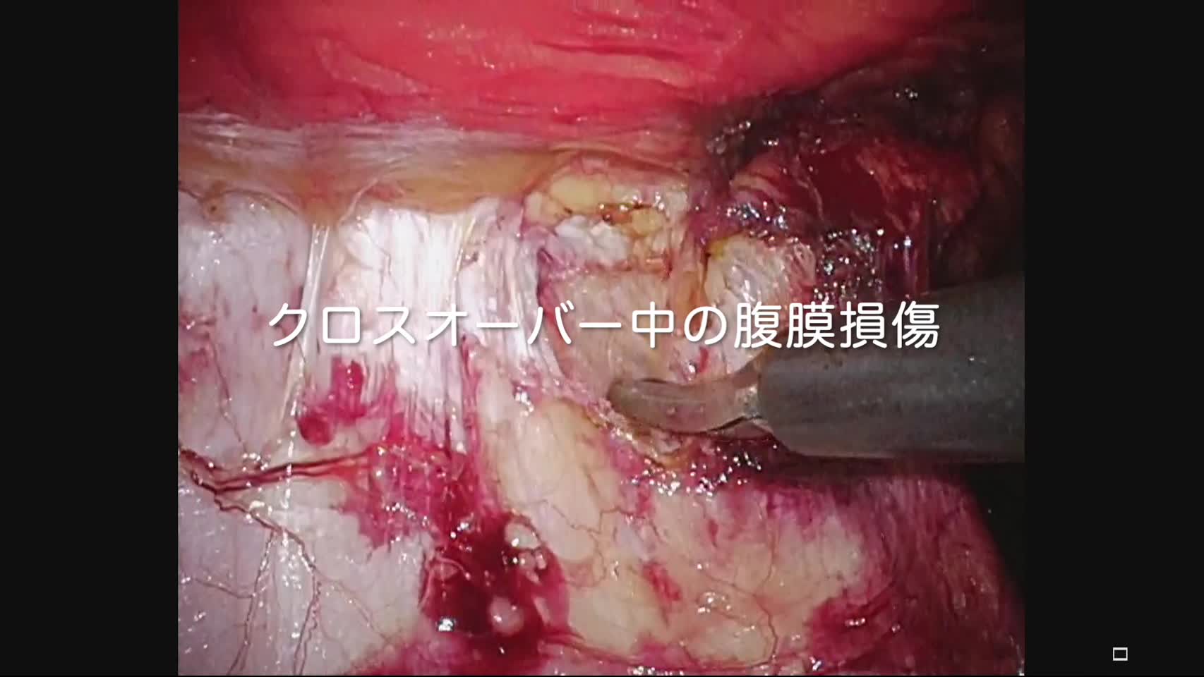 78-04-052谷岡論文　動画2図3