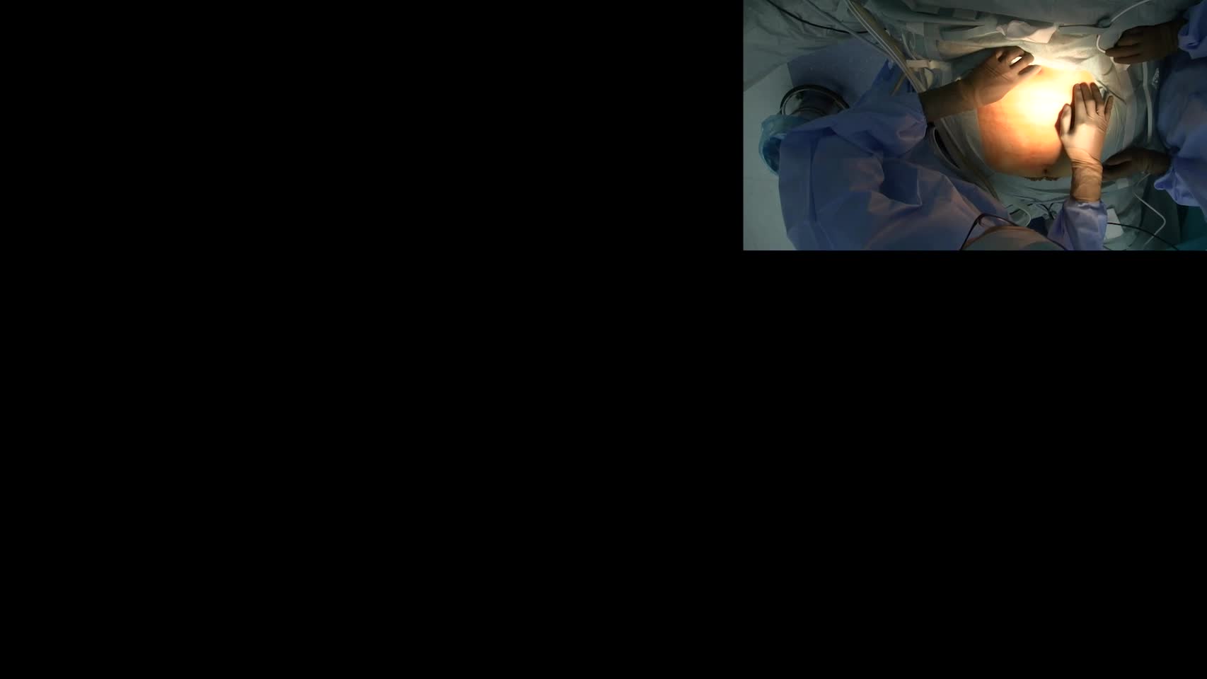 78-04-151網木論文　動画1図6