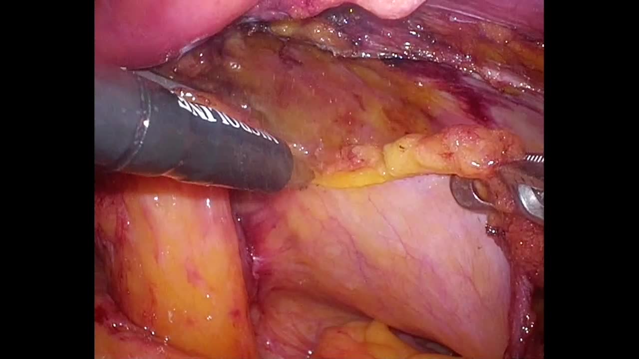 78-04-102小丹枝論文　動画2図6,7