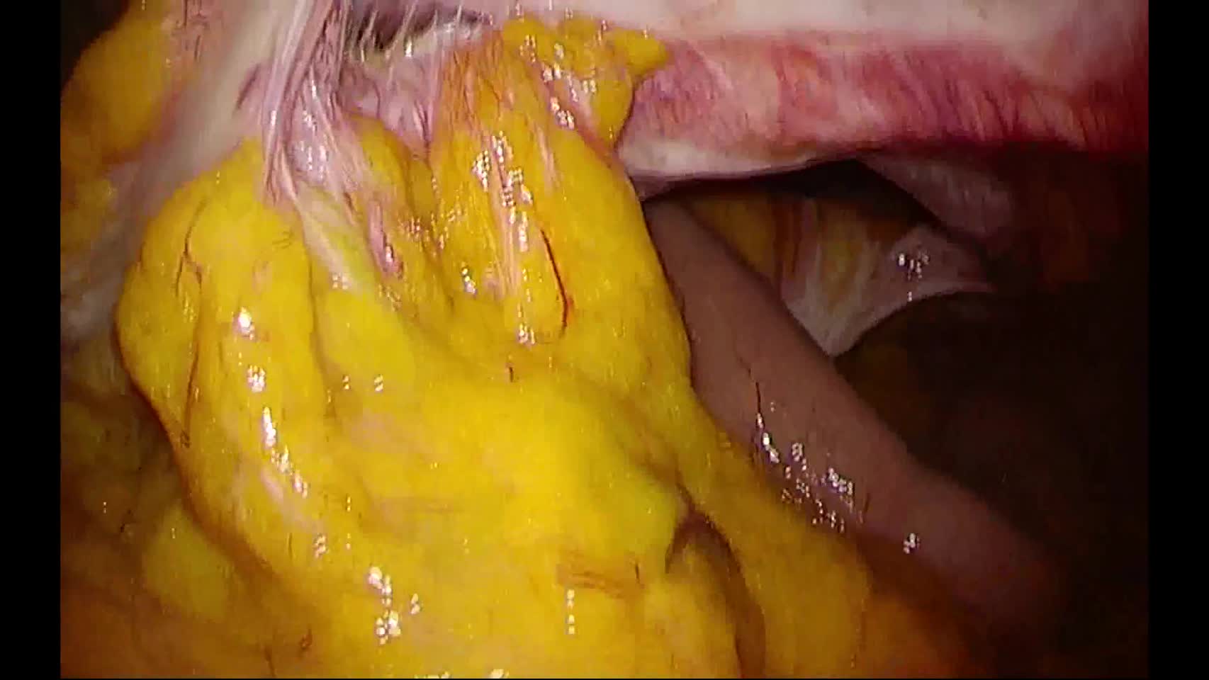 78-04-164湯浅論文　動画4図5