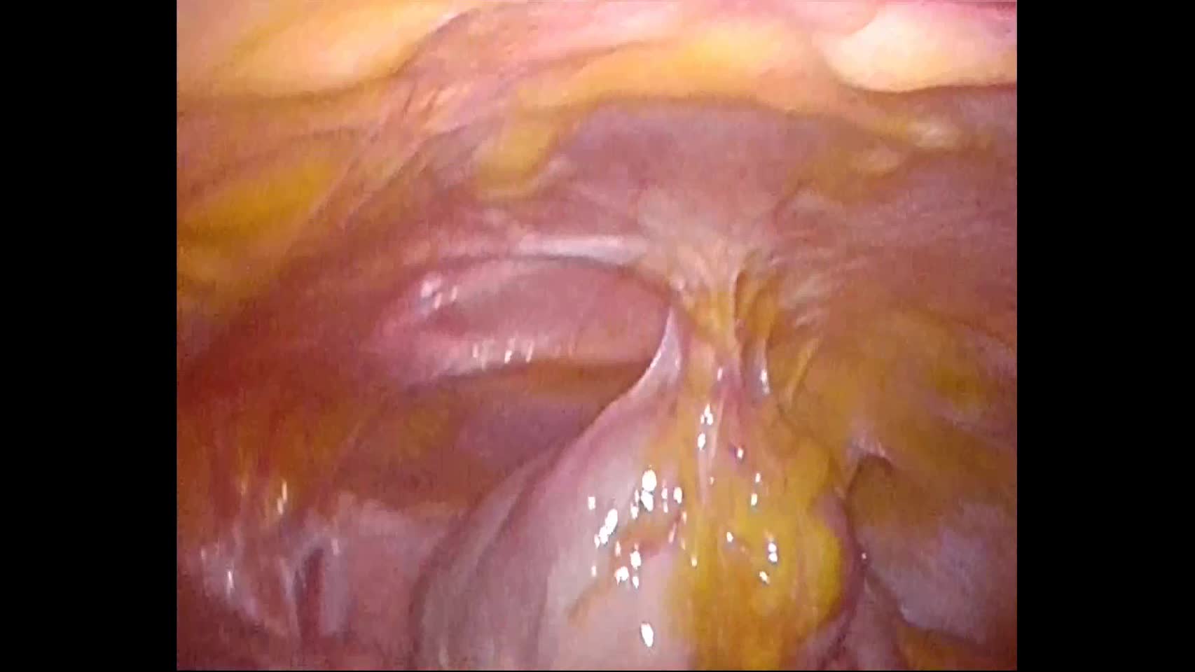 78-04-165湯浅論文　動画5図6