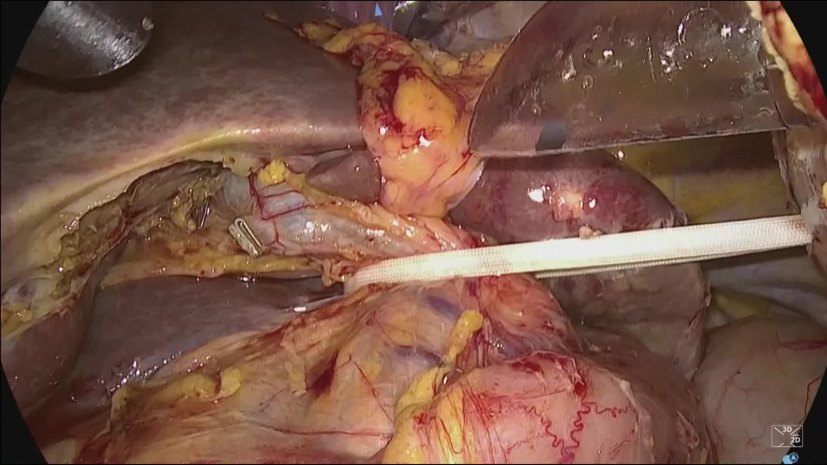 78-03-042三島論文　動画2図6