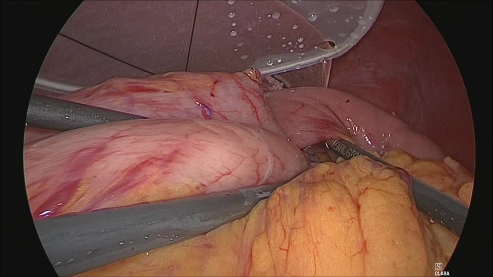 78-05-061辻論文　動画１　図３　DT with NI　...