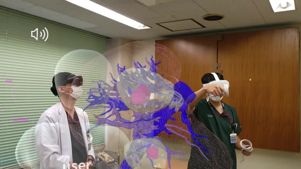 78-02-151脊山論文　動画１ 
