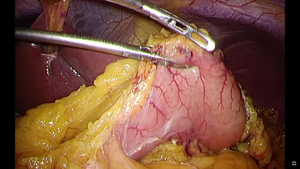 78-06-082海藤論文　動画２　図４