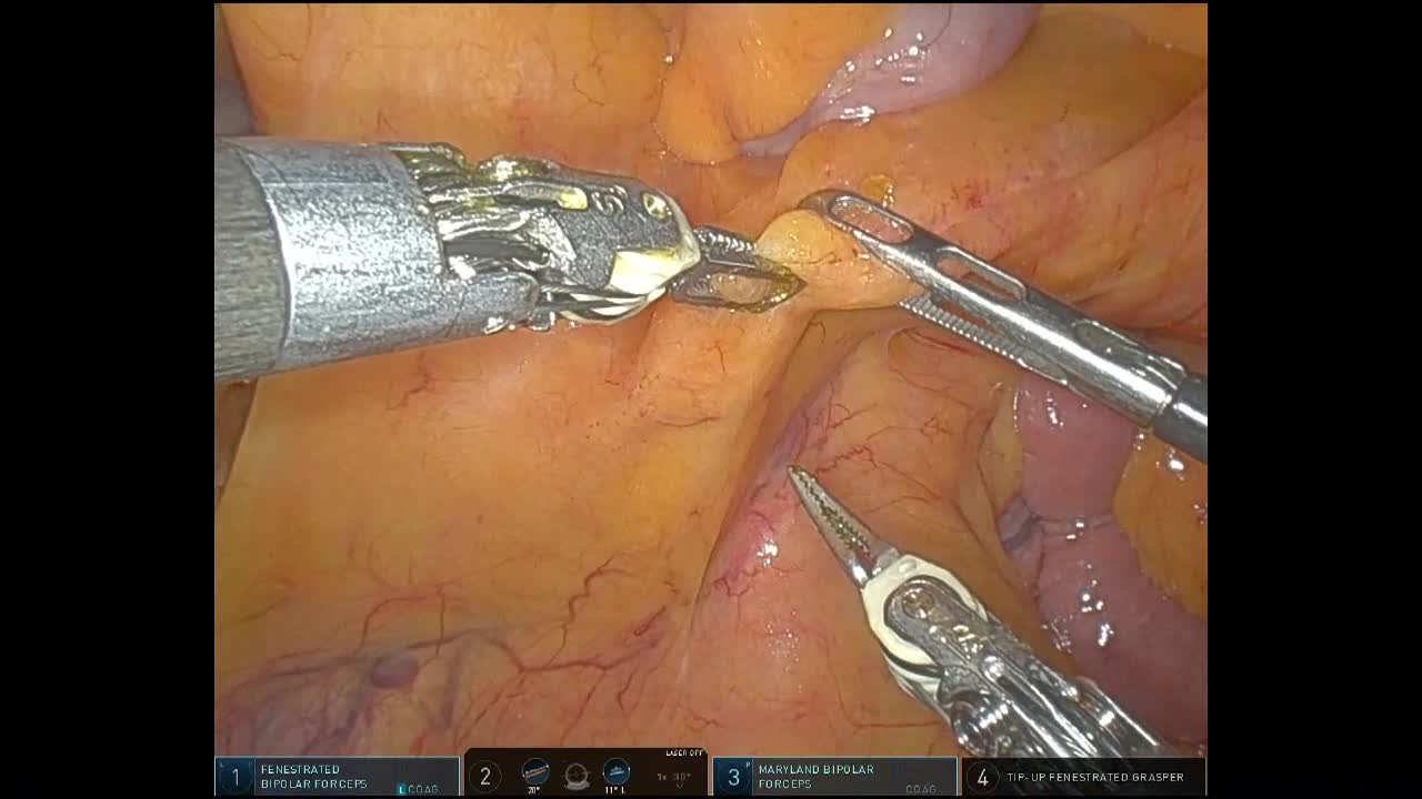 78-08-131髙橋論文　動画１　図2-5