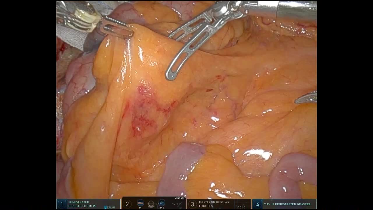 78-08-132髙橋論文　動画２　図6,7
