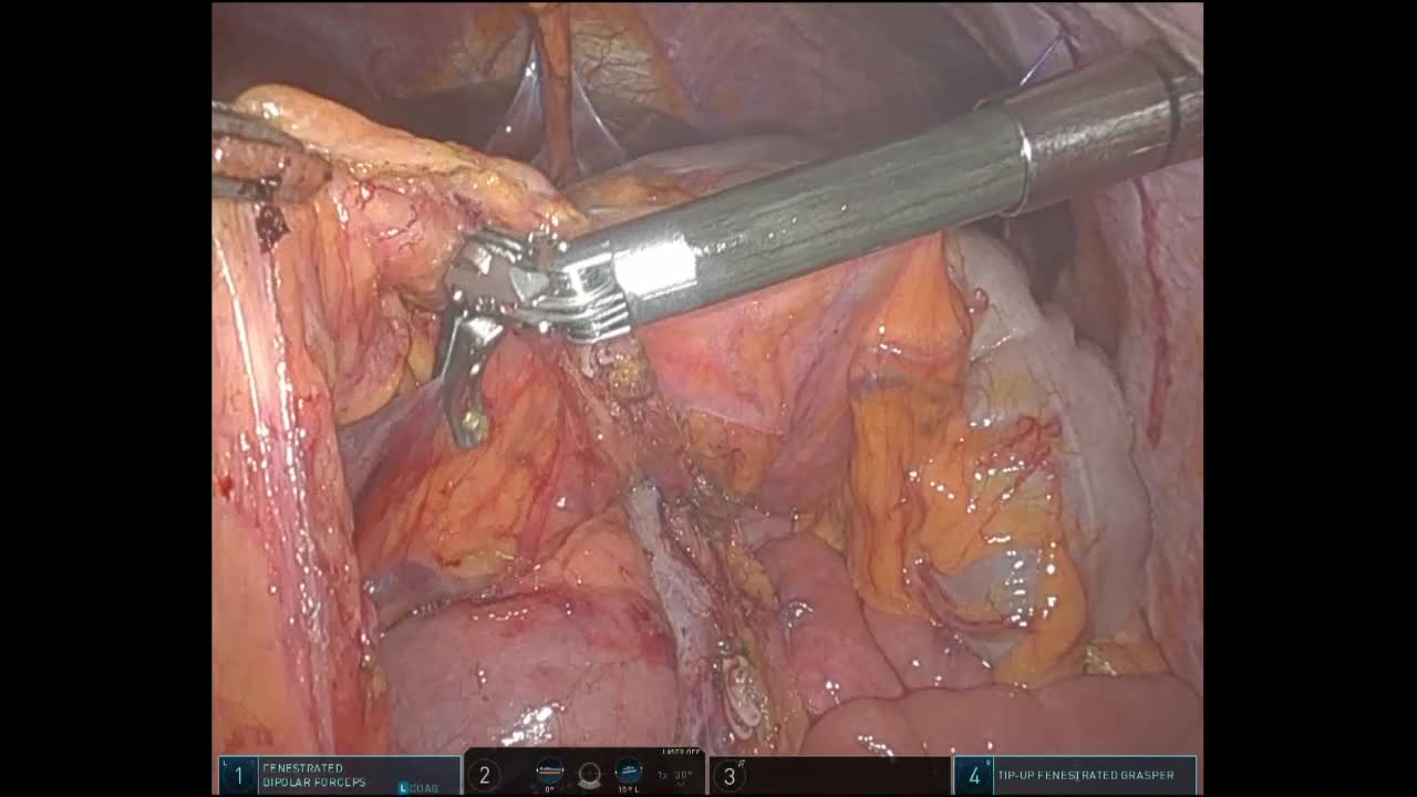78-08-133髙橋論文　動画３　図８