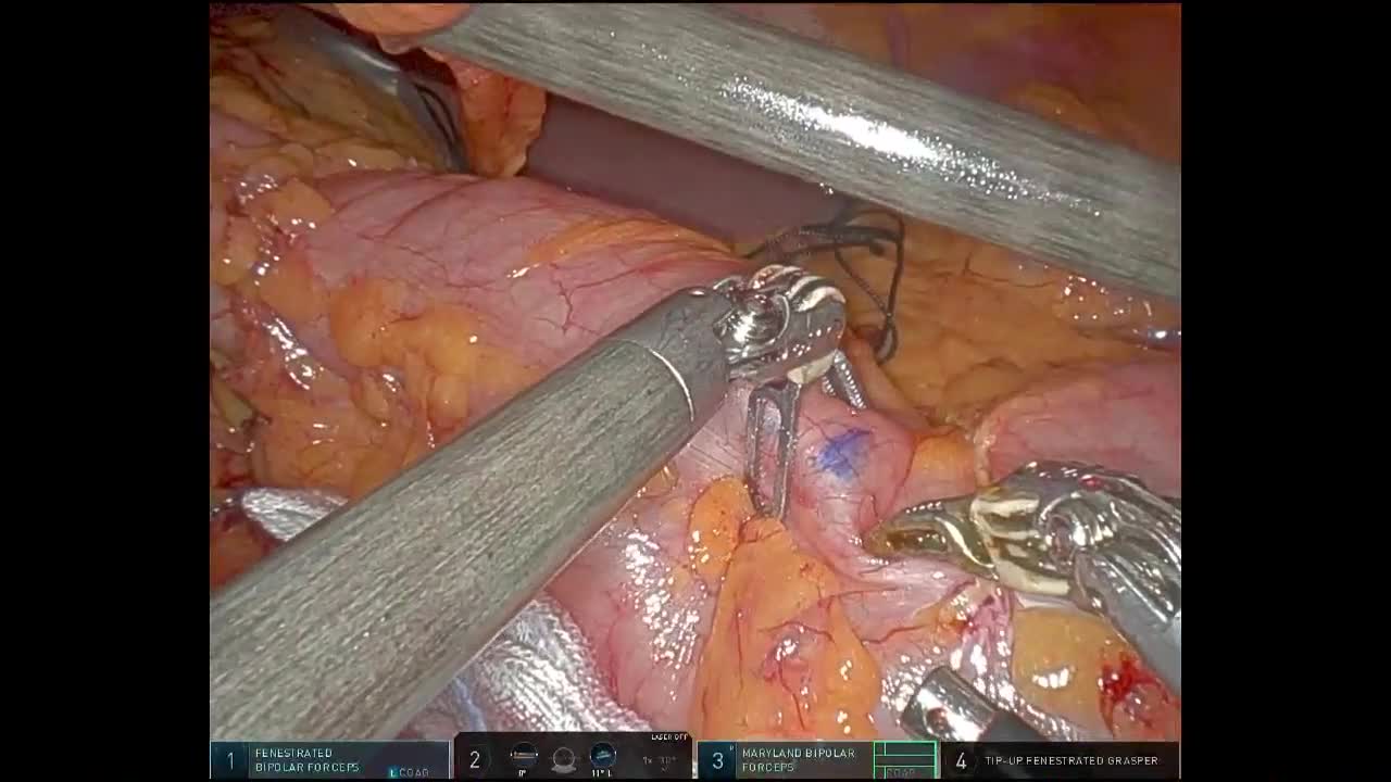 78-08-134髙橋論文　動画４　図11,12