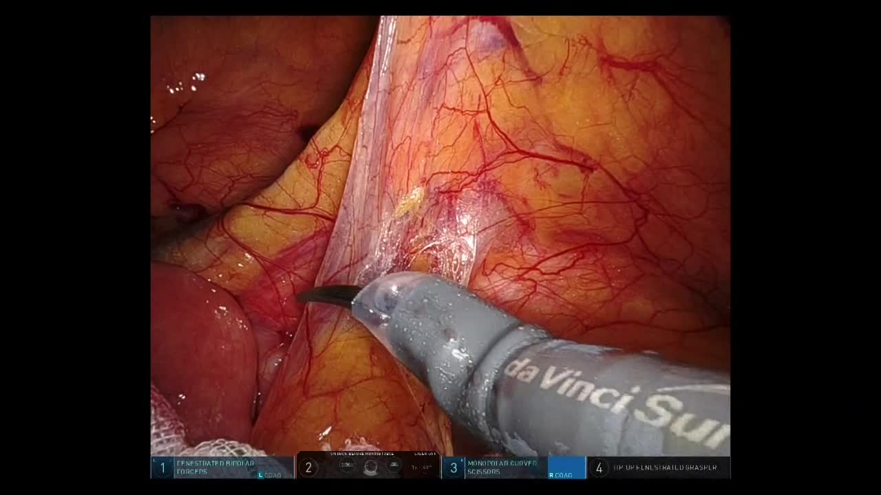 78-08-141髙岡論文　動画１（４倍速）図２－６　 LHC...