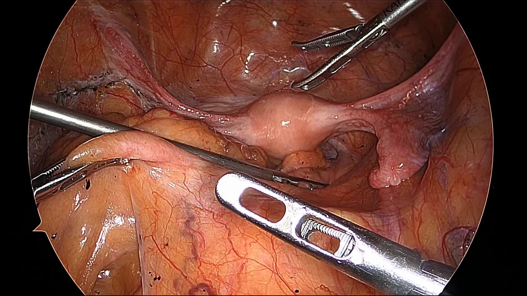 kd78008植村論文　動画１ 