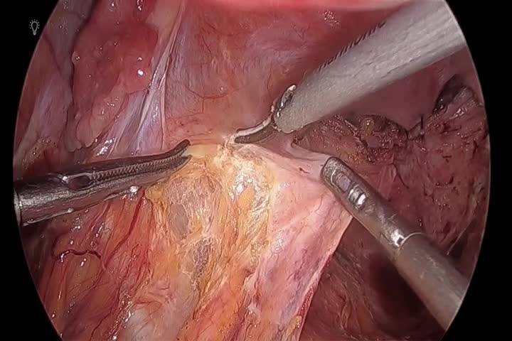kd78010植村論文　動画３