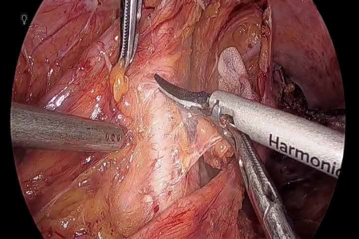 kd78011植村論文　動画４
