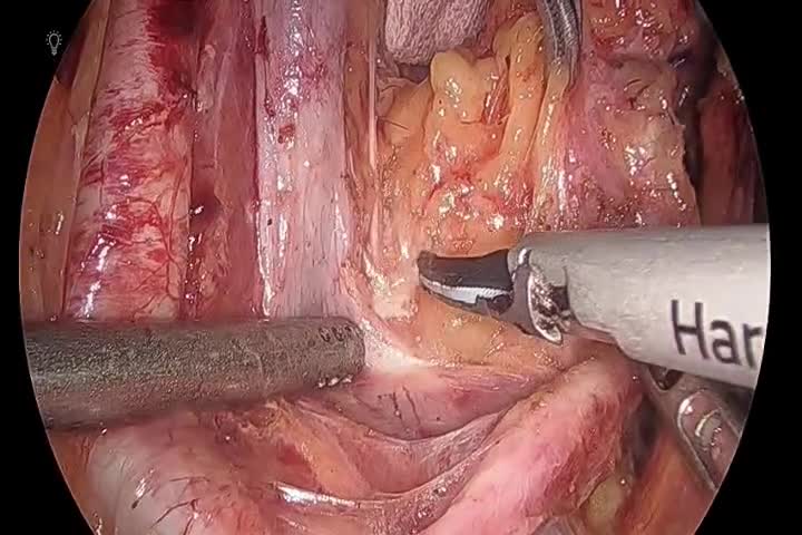kd78012植村論文　動画５