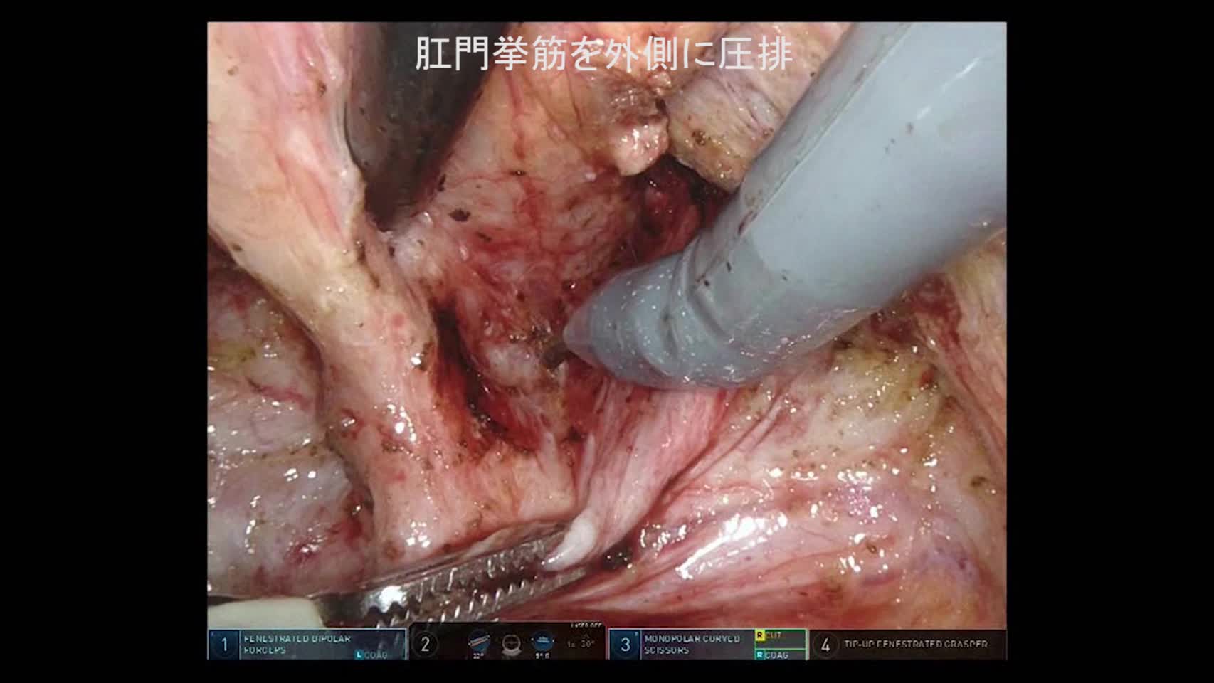 78-09-092櫻井論文　動画２