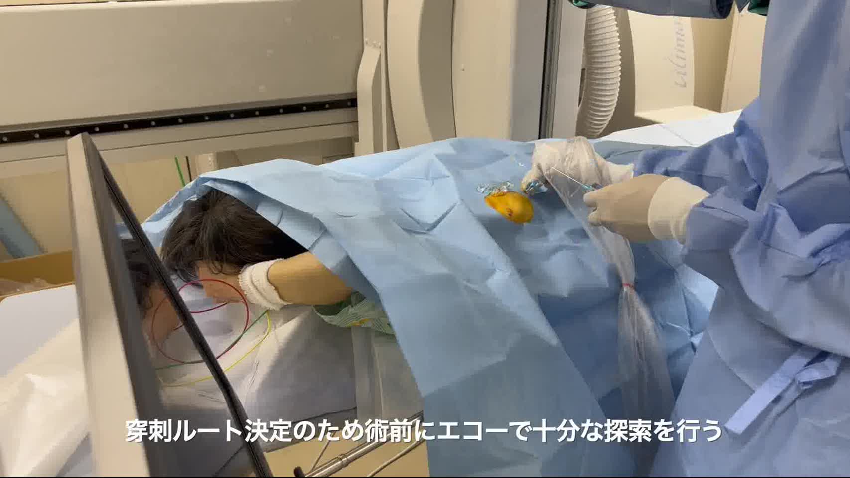 78-11-072皆川論文　動画2　PTBD