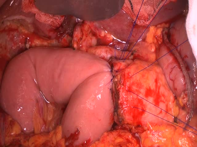 79-04-113　動画３　図5