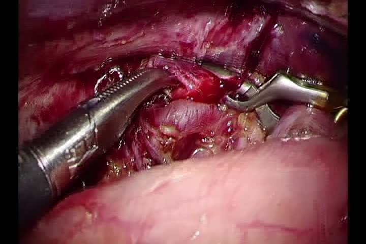 79-04-142　動画２　図17