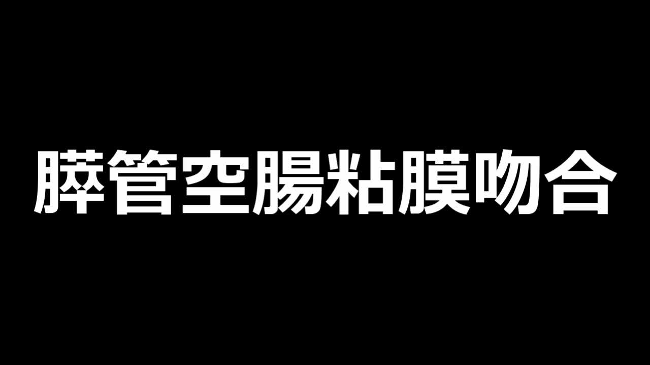 79-04-125　動画５　図４　膵管空腸粘膜縫合の運針と結紮...