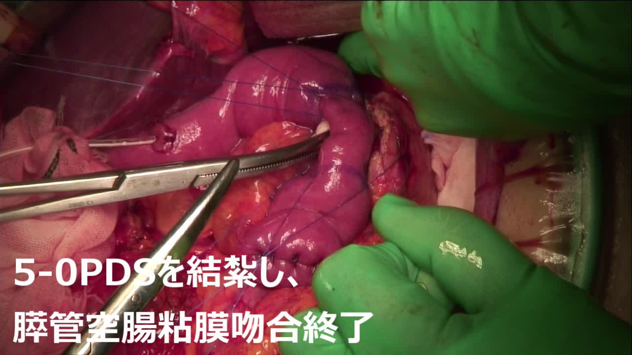 79-04-128　動画８　図５　密着吻合の結紮...