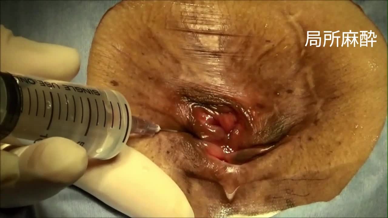 79-11-251松島論文　動画１　図2～4, 7