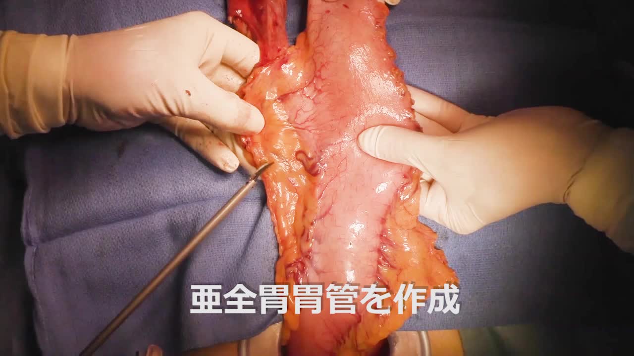 79-08-083　動画３　図5～7　吻合