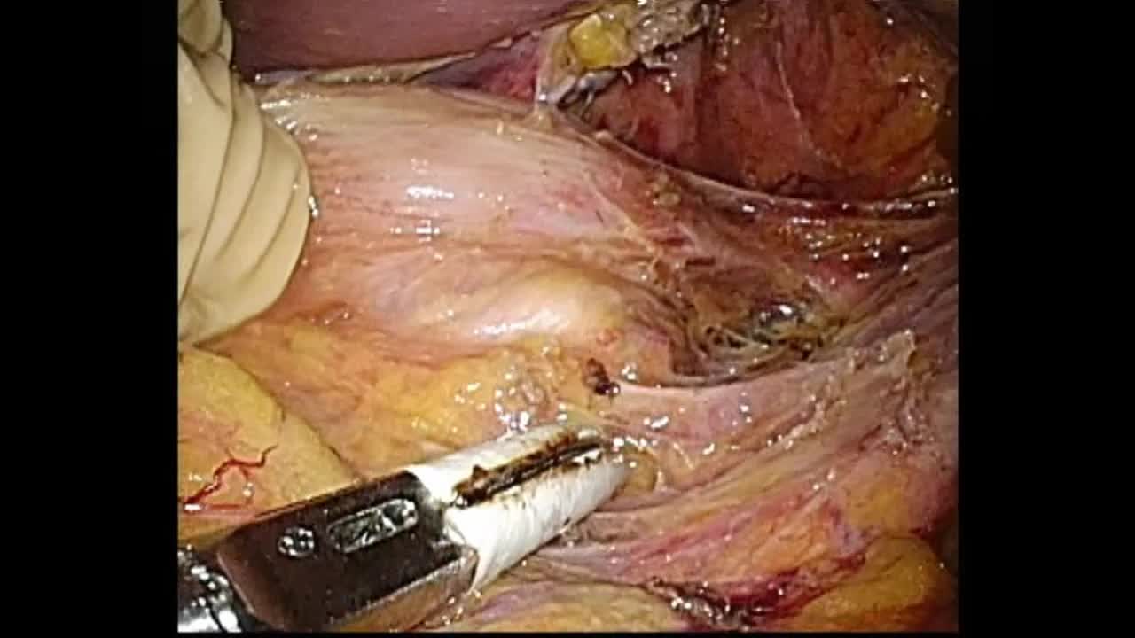 79-11-053_動画3_図3b