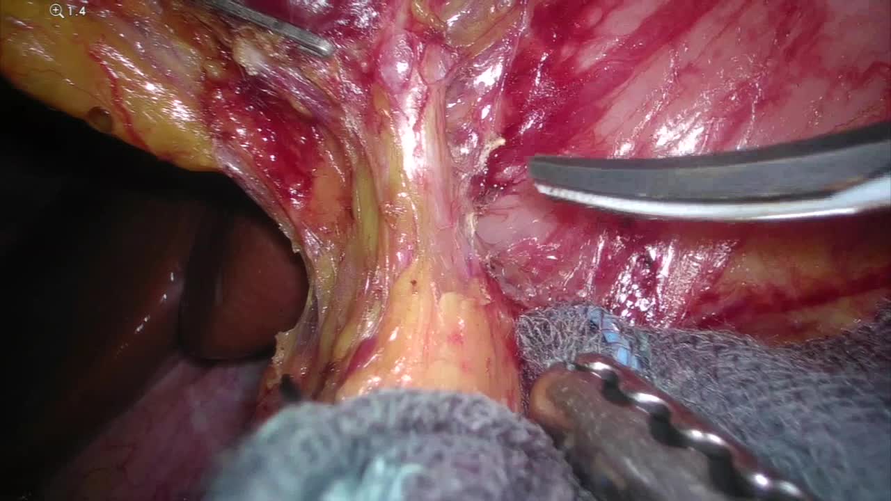 79-11-073_動画3_図3