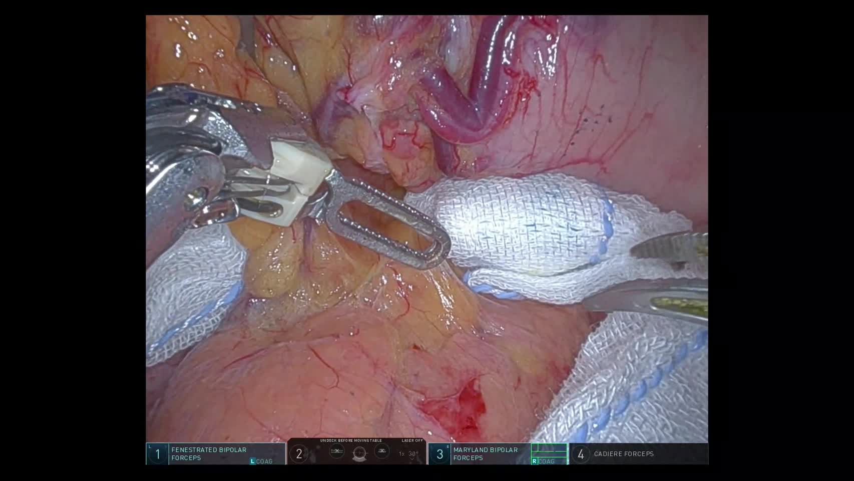 79-11-084_動画4_図5a,b