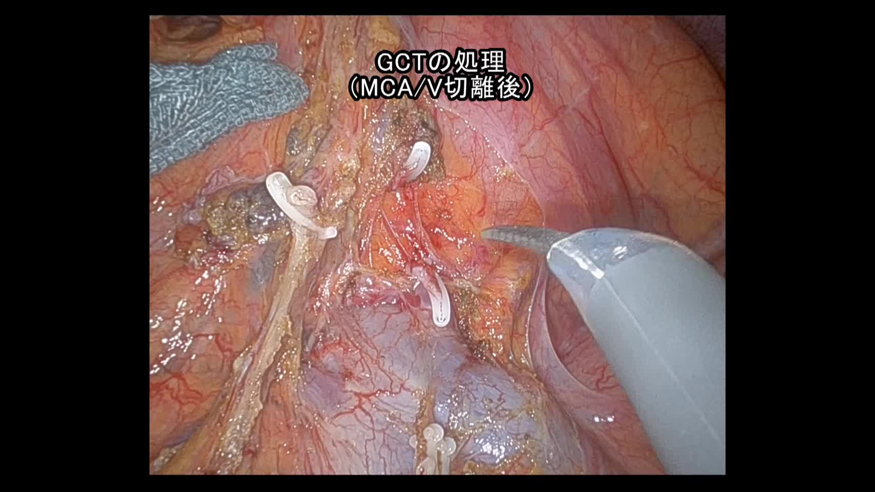 79-11-132_動画2_図9