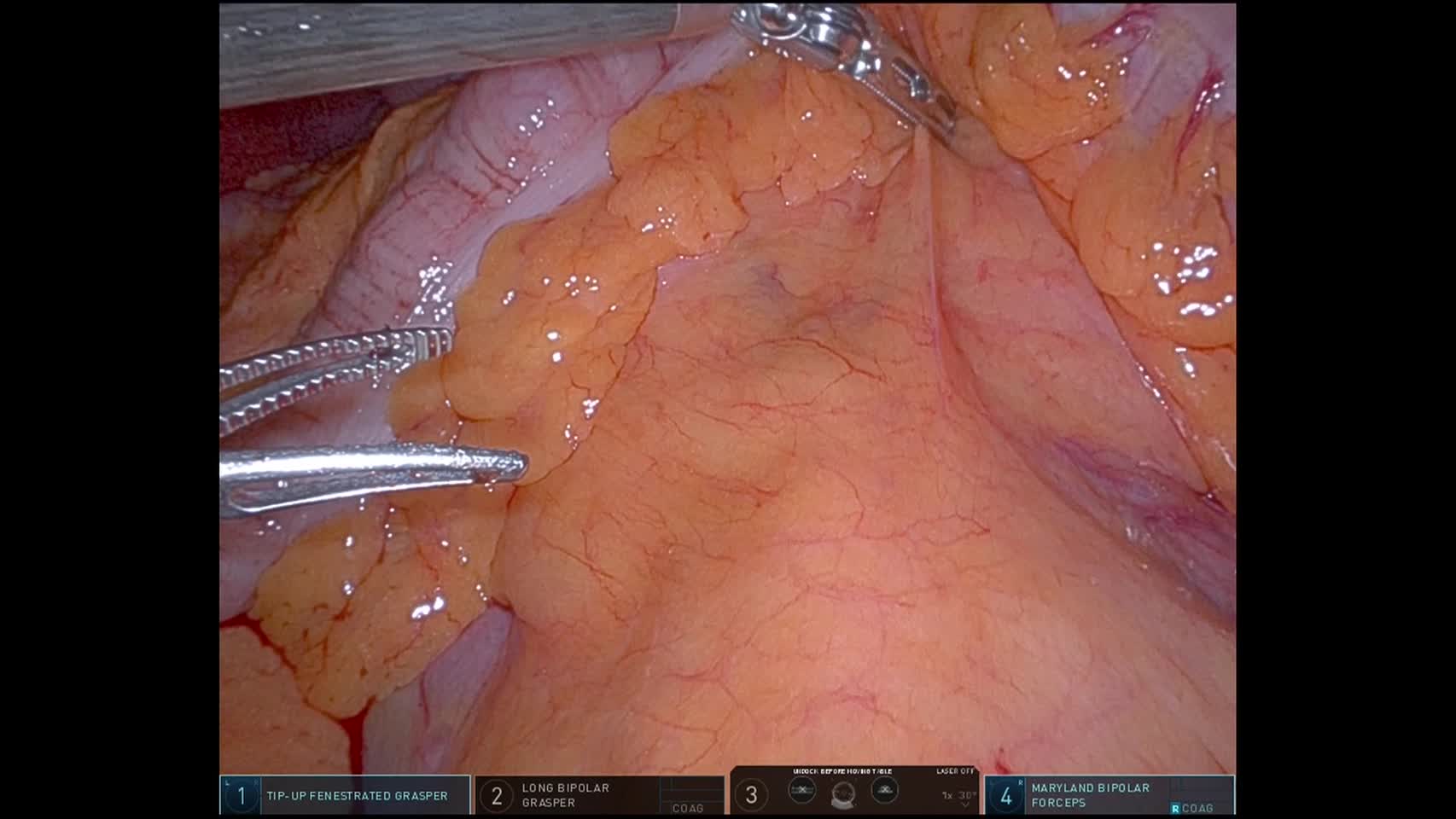 79-11-361木谷論文　動画１　図2a～d   mesenteric-left...