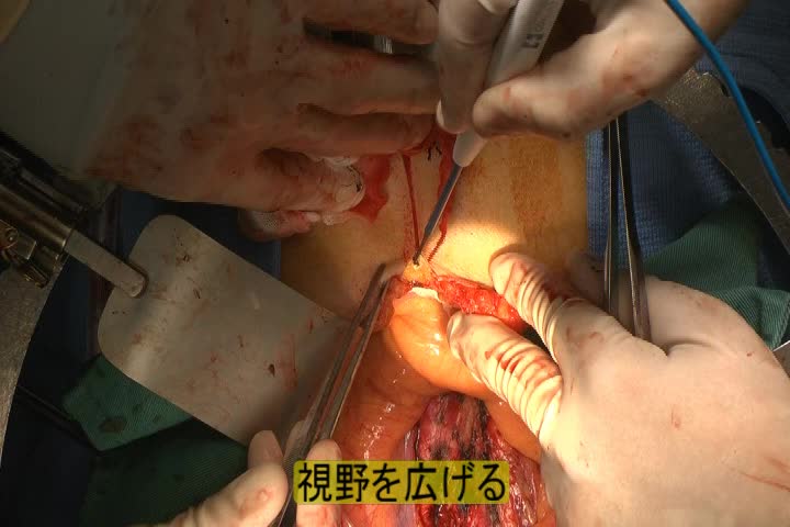 79-11-191_動画1