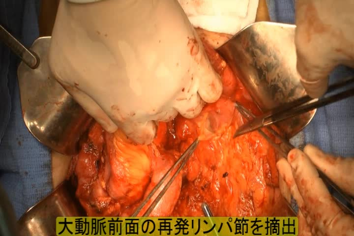 79-11-192_動画2