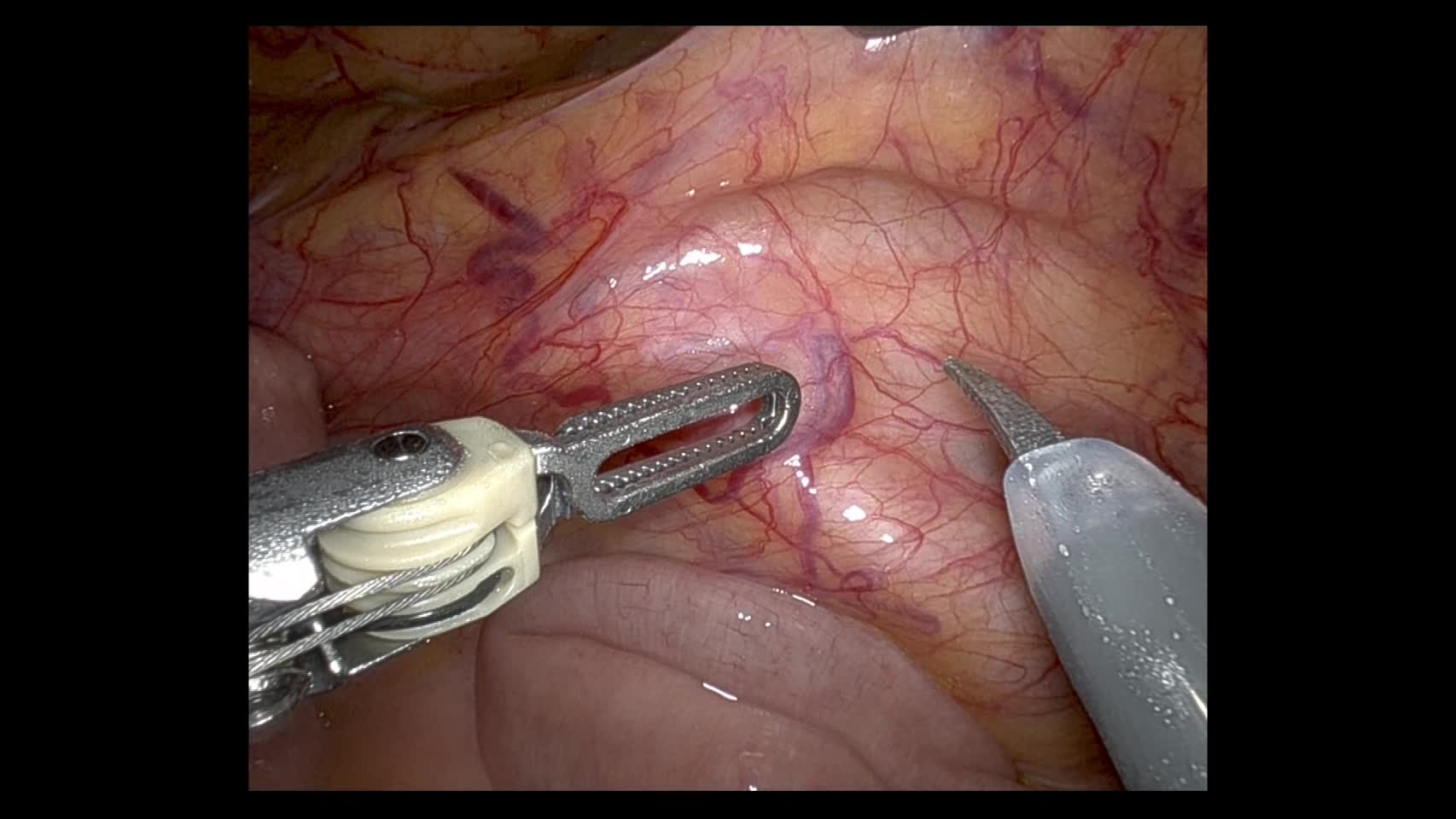 79-11-201_動画1_図1a