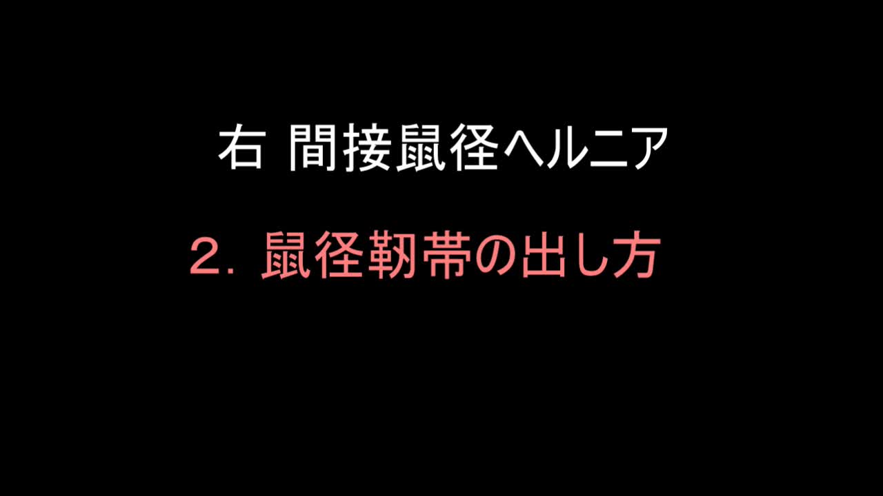79-11-412三澤論文　動画２　図４　鼠径靭帯の出し方...