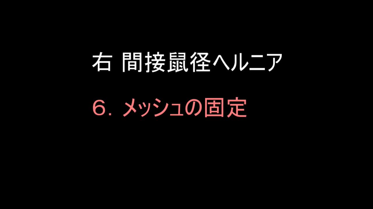 79-11-416三澤論文　動画６　図９　メッシュの固定...