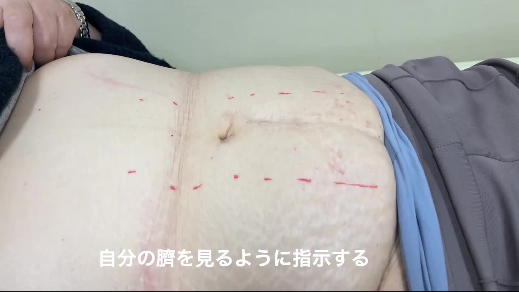 79-12-hd061　動画 1 　図１