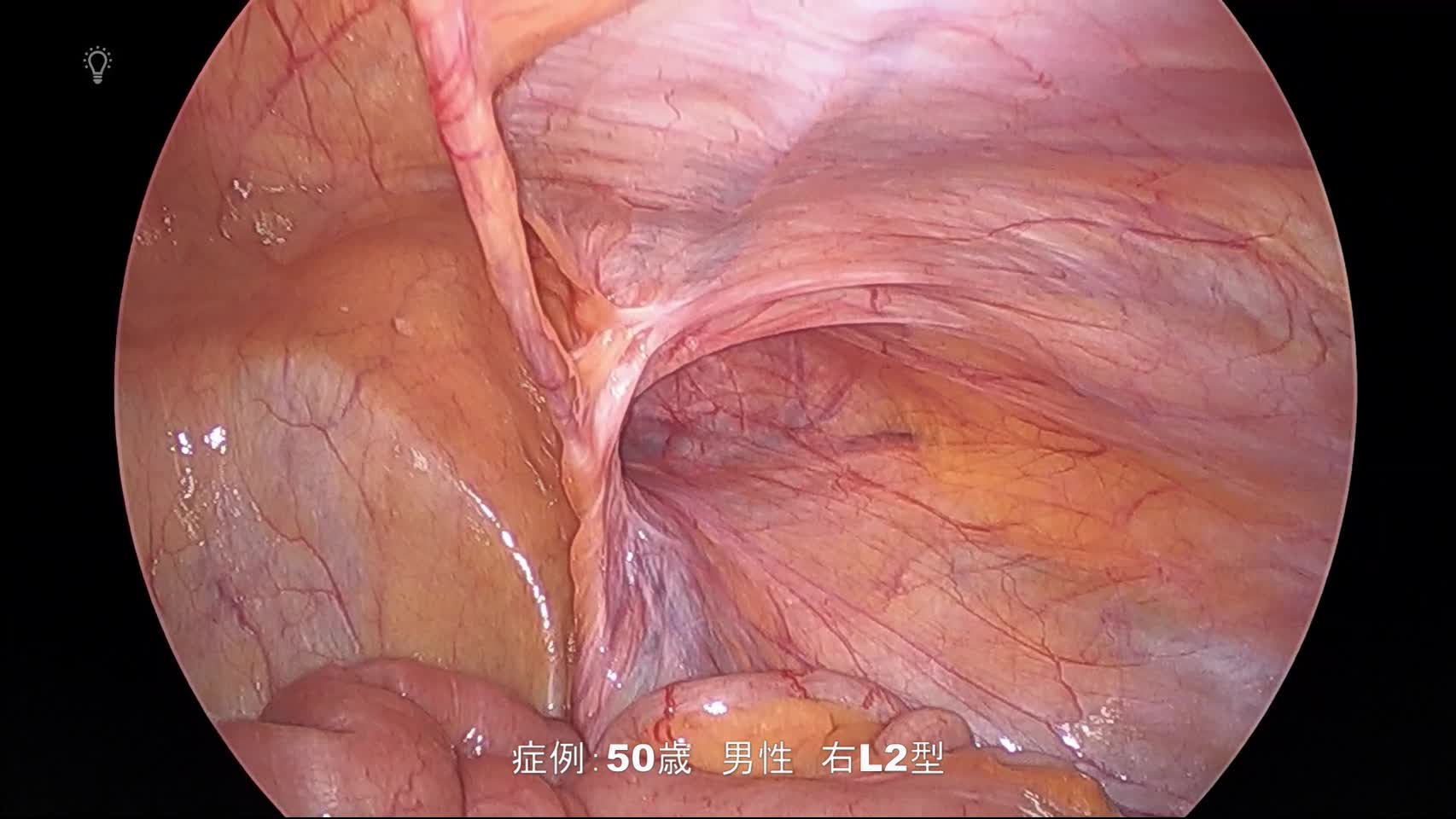 WK2401蜂谷論文　私の工夫　動画