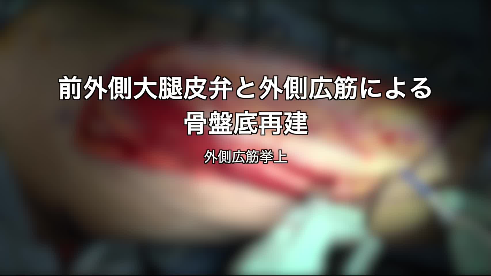 80-06-102赤澤論文　動画２　図4,5  外側広筋挙上...